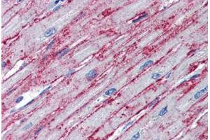 Human Heart (formalin-fixed, paraffin-embedded) stained with PNPT1 antibody ABIN462230 followed by biotinylated goat anti-rabbit IgG secondary antibody ABIN481713, alkaline phosphatase-streptavidin and chromogen. (PNPT1 抗体  (AA 489-538))