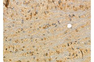ABIN6266149 and ABIN6277117 at 1/100 staining Rat brain tissue by IHC-P. (ZYX 抗体  (Internal Region))