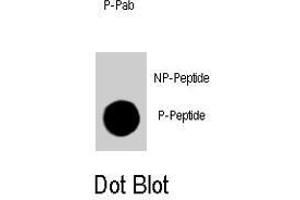 Dot blot analysis of CDKN1B (phospho T198) polyclonal antibody  on nitrocellulose membrane. (CDKN1B 抗体  (pThr198))