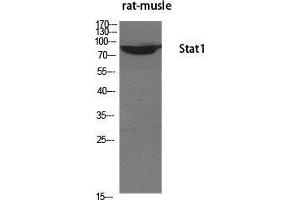 Western Blot (WB) analysis of specific cells using Stat1 Polyclonal Antibody. (STAT1 抗体  (Tyr1217))