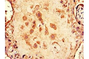Immunohistochemistry of paraffin-embedded human placenta tissue using ABIN7146624 at dilution of 1:100 (ARPP19 抗体  (AA 2-105))