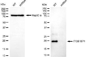 Western blotting analysis using ITGB1BP1 antibody (ABIN7799068). (ITGB1BP1 抗体)