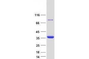 Validation with Western Blot