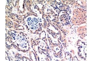 Immunohistochemistry (IHC) image for anti-BCL2-Associated X Protein (BAX) antibody (ABIN7189545)