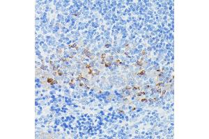 Immunohistochemistry of paraffin-embedded mouse spleen using CD225/IFITM1 antibody (ABIN1680390, ABIN3018715, ABIN3018716 and ABIN6220553) at dilution of 1:100 (40x lens). (IFITM1 抗体  (C-Term))