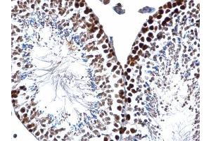 IHC-P Image PCNA antibody detects PCNA protein at nucleus on mouse testis by immunohistochemical analysis. (PCNA 抗体)