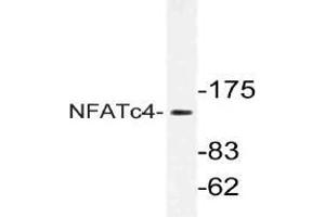 Western blot analysis of NFATc4 Antibody NFATc4 in extracts from Jurkat cells. (NFATC4 抗体)