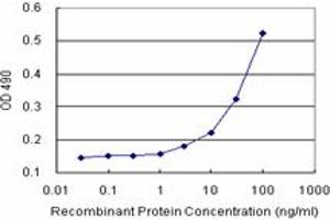 SERPINA3 (Human) Matched Antibody Pair