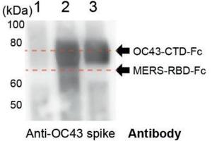 Purified protein identities were further confirmed by Western blot analysis using an anti‐OC43 spike antibody. (hCoV-OC43 Spike 抗体  (AA 15-344))