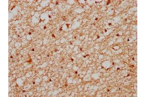 IHC image of ABIN7164186 diluted at 1:400 and staining in paraffin-embedded human brain tissue performed on a Leica BondTM system.