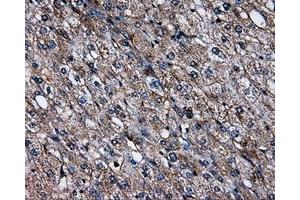 Immunohistochemical staining of paraffin-embedded liver tissue using anti-SATB1mouse monoclonal antibody. (SATB1 抗体)