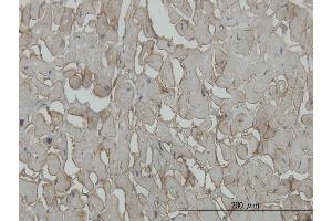 Immunoperoxidase of monoclonal antibody to SGCB on formalin-fixed paraffin-embedded human heart. (SGCB 抗体  (AA 87-196))