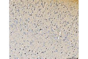 IHC analysis of Histidine Decarboxylase/HDC using anti-Histidine Decarboxylase/HDC antibody (ABIN7599827).