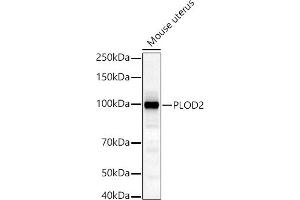 Western blot analysis of extracts of Mouse uterus, using PLOD2/LH2 antibody (ABIN6132888, ABIN6145788, ABIN6145790 and ABIN6222693) at 1:1000 dilution. (PLOD2 抗体  (AA 470-650))