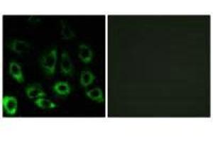 Immunofluorescence analysis of A549 cells, using MBTPS2 antibody. (MBTPS2 抗体)