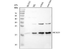 Western blot analysis of NCALD using anti-NCALD antibody (ABIN7601173).