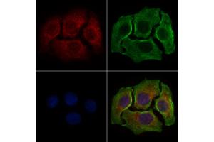 ABIN6258520 and ABIN6274742 staining HepG2 cells by IF/ICC.