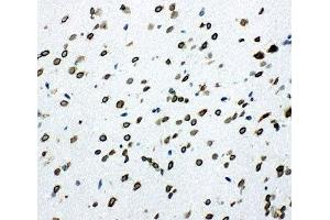 IHC-F testing of SHC antibody and rat brain tissue