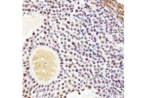 Wee2 antibody immunohistochemistry analysis in formalin fixed and paraffin embedded mouse ovarian tissue. (WEE2 抗体  (AA 364-393))