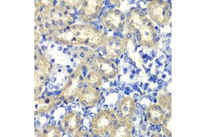 Immunohistochemistry of paraffin-embedded rat kidney using ABAT antibody (ABIN1876487) at dilution of 1:100 (40x lens). (ABAT 抗体)