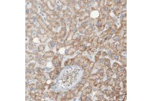 Immunohistochemical staining (Formalin-fixed paraffin-embedded sections) of human liver with SDHB monoclonal antibody, clone CL0346  shows moderate cytoplasmic positivity in the hepatocytes. (SDHB 抗体)