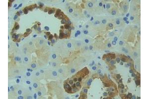 DAB staining on IHC-P; Samples: Human Kidney Tissue (RYK 抗体  (AA 308-570))