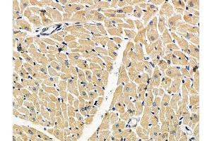 ABIN7096706 and ABIN7100771 at 1/100 staining rat heart tissue by IHC-P.