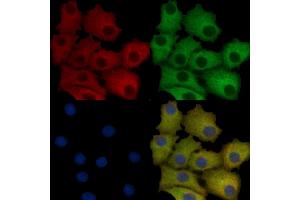 GRP78 Mouse monoclonal Antibody staining HepG2 cells by IF/ICC.