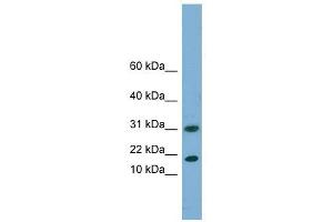EIF5A2 antibody used at 1 ug/ml to detect target protein. (EIF5A2 抗体  (N-Term))