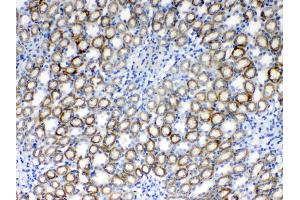 IHC analysis of RPS6 using anti- RPS6 antibody . (RPS6 抗体  (N-Term))
