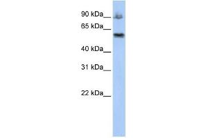 ASCC2 antibody used at 1 ug/ml to detect target protein. (ASCC2 抗体  (Middle Region))