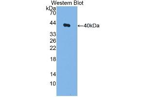 Detection of Recombinant F1+2, Rat using Polyclonal Antibody to Prothrombin Fragment 1+2 (F1+2) (Prothrombin Fragment 1+2 抗体  (AA 44-323))