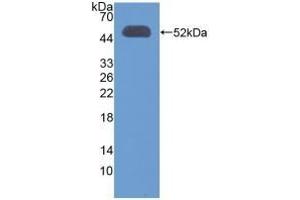 Detection of Recombinant OXCT1, Human using Polyclonal Antibody to 3-Oxoacid Coenzyme A Transferase 1 (OXCT1) (OXCT1 抗体  (AA 40-489))