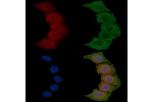 ABIN6257413 and ABIN6275351 staining Hela cells(45 min of heat-shock) by IF/ICC. (PEX7 抗体  (C-Term))