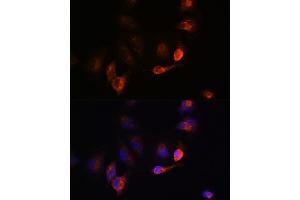 Immunofluorescence analysis of U-251MG cells using B antibody (ABIN6129977, ABIN6137413, ABIN6137415 and ABIN6220894) at dilution of 1:100. (BACE1 抗体  (AA 22-322))