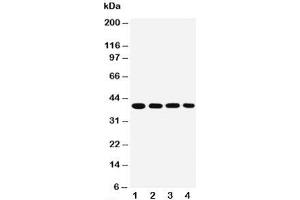 Western blot testing of MTCO1 antibody and Lane 1:  SMMC-7721;  2: MCF-7;  3: Raji;  4: SW620 cell lysate (COX1 抗体  (C-Term))