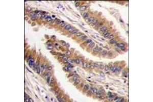 Image no. 2 for anti-Protein Kinase, X-Linked (PRKX) (C-Term) antibody (ABIN360336) (PRKX 抗体  (C-Term))