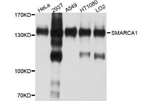 Western blot analysis of extracts of various cell lines, using SMARCA1 antibody. (SMARCA1 抗体)