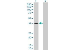 Western Blot analysis of CTSL1 expression in transfected 293T cell line by CTSL1 MaxPab polyclonal antibody. (Cathepsin L 抗体  (AA 1-333))