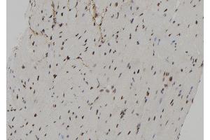 ABIN6267172 at 1/100 staining Mouse heart tissue by IHC-P.