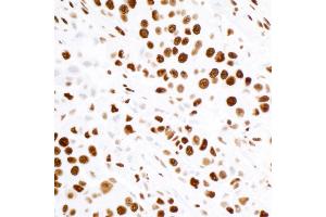 Immunohistochemistry (IHC) image for anti-Tripartite Motif Containing 28 (TRIM28) (Ser824) antibody (ABIN7454012) (Recombinant KAP1 抗体  (Ser824))