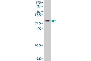 Western Blot detection against Immunogen (38. (ADCY5 抗体  (AA 1152-1261))