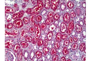 Immunohistochemistry (IHC) image for anti-ATPase, H+ Transporting, Lysosomal 56/58kDa, V1 Subunit B2 (ATP6V1B2) antibody (ABIN961324)