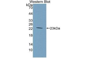 Western Blotting (WB) image for anti-Glucokinase (Hexokinase 4) Regulator (GCKR) (AA 90-286) antibody (ABIN3201594) (GCKR 抗体  (AA 90-286))
