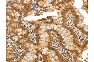 ABIN6259742 and ABIN6272985 at 1/100 staining Rat colon tissue by IHC-P.