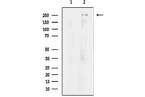 anti-C-Ros Oncogene 1 , Receptor tyrosine Kinase (ROS1) (C-Term) antibody