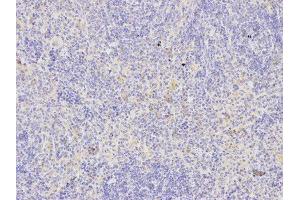Immunohistochemistry (IHC) image for anti-TNF Receptor Superfamily, Member 6 (FAS) (AA 150-250) antibody (ABIN3020739) (FAS 抗体  (AA 150-250))