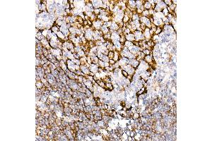 Immunohistochemistry of paraffin-embedded Human tonsil using CD35/CR1 antibody (ABIN7266477) at dilution of 50 (40x lens). (CD35 抗体)