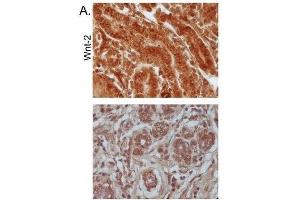 Immunohistochemistry (Paraffin-embedded Sections) (IHC (p)) image for anti-Wingless-Type MMTV Integration Site Family Member 2 (WNT2) (AA 221-320) antibody (ABIN762896)
