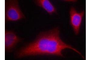 Immunofluorescence staining of methanol-fixed Hela cells using PKD/PKCm(Phospho-Ser910) Antibody. (PKC mu 抗体  (pSer910))